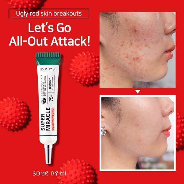 Somebymi Super Miracle Spot All Cream (acne spot care),30ml
